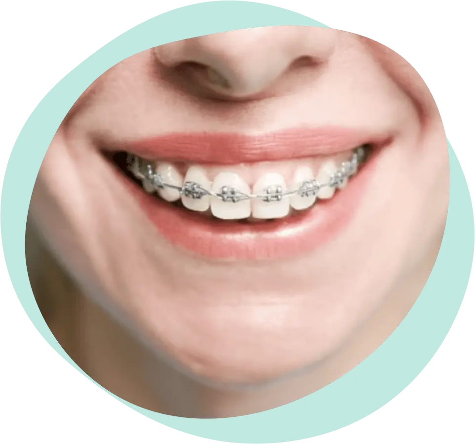 Fiksna Proteza slika