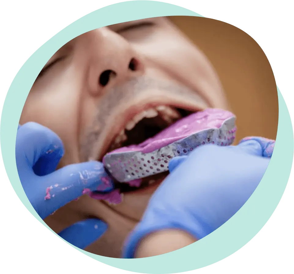 Postupak postavljanja fiksne proteze