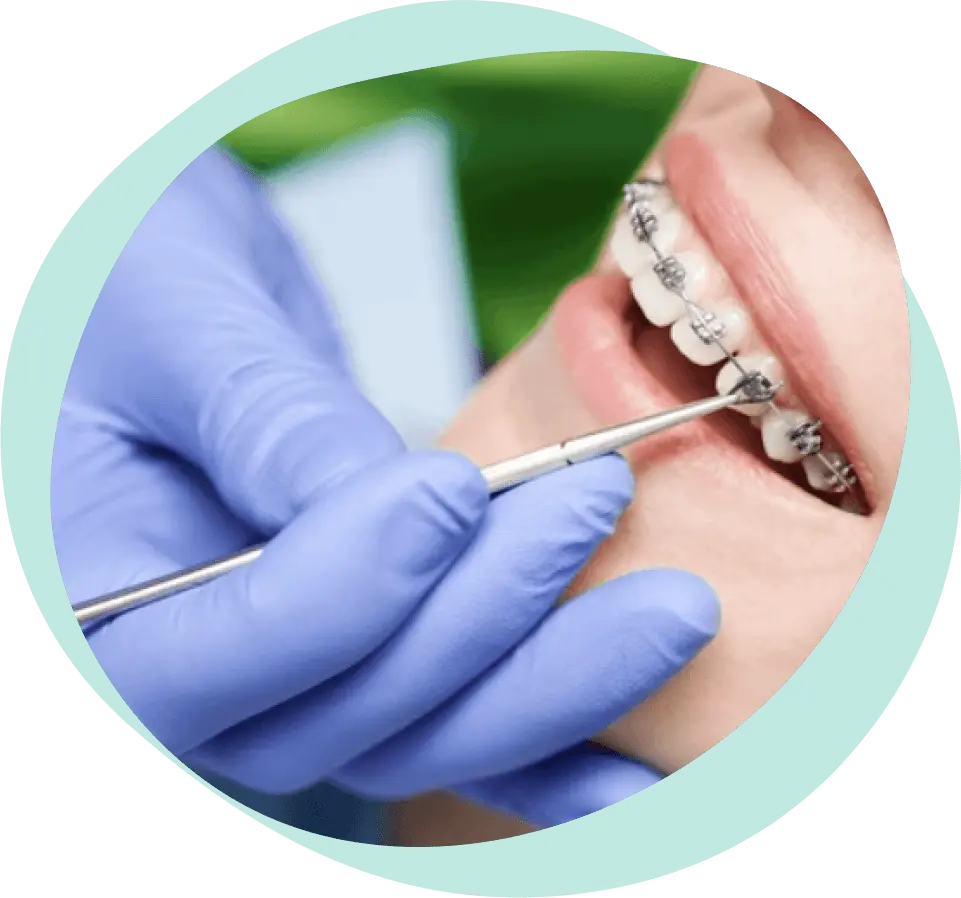 Za koga su fiksne proteze